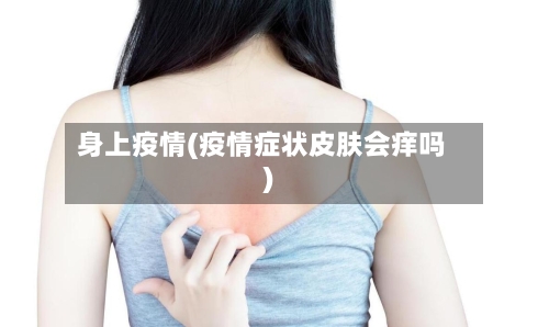 身上疫情(疫情症状皮肤会痒吗)-第3张图片