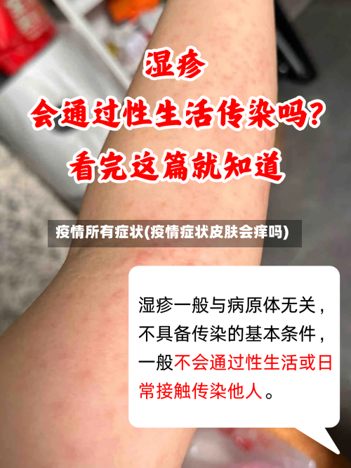 疫情所有症状(疫情症状皮肤会痒吗)