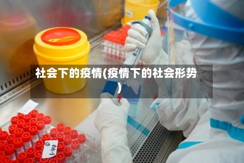 社会下的疫情(疫情下的社会形势)-第2张图片