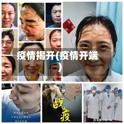 疫情揭开(疫情开端)-第2张图片