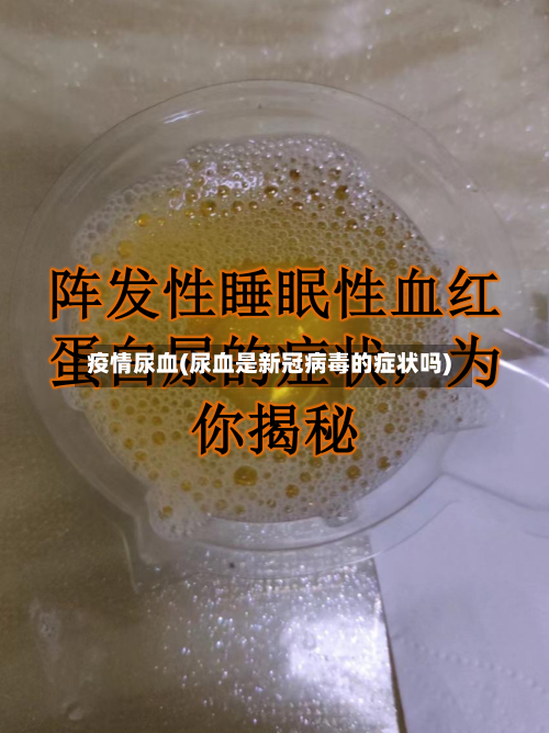 疫情尿血(尿血是新冠病毒的症状吗)